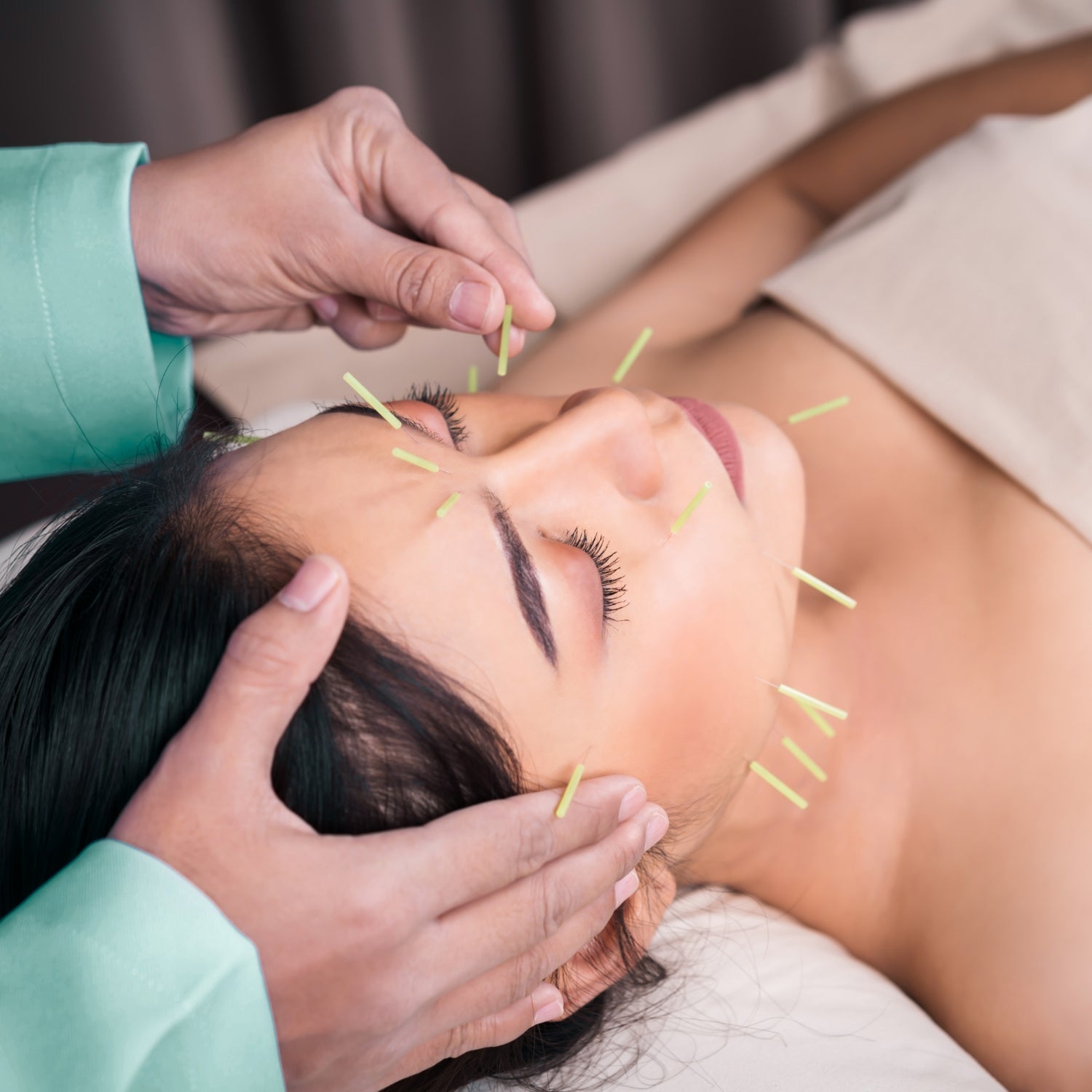 ACUPUNTURA FACIAL