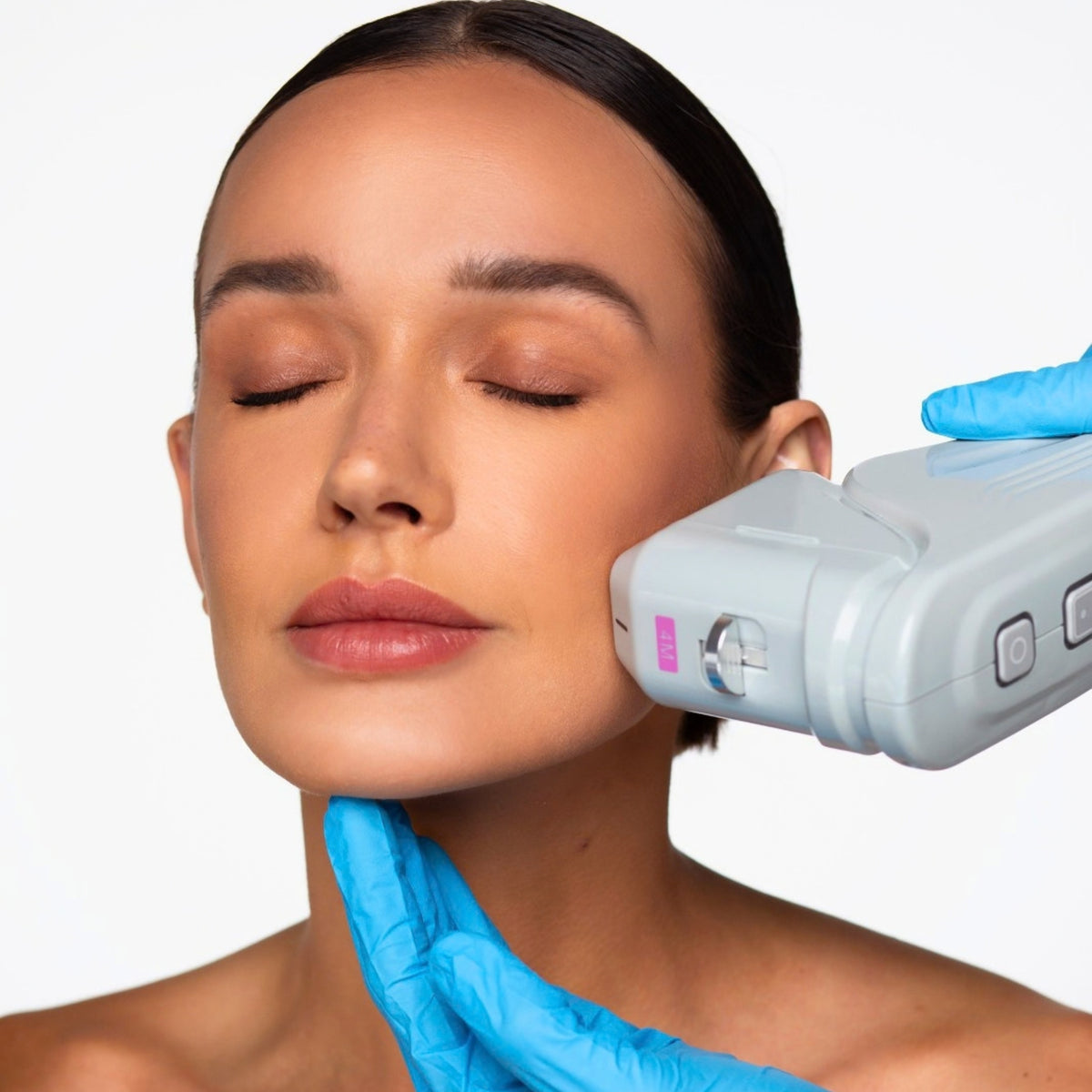 HIFU 12D Facial + PDRN de Salmón