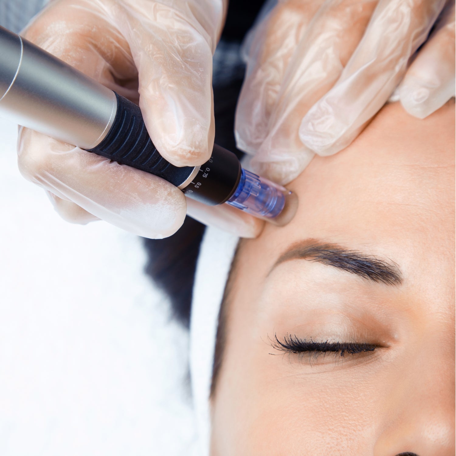 Mesoterapia / Dermapen | Polinucleótidos (ADN Salmón)