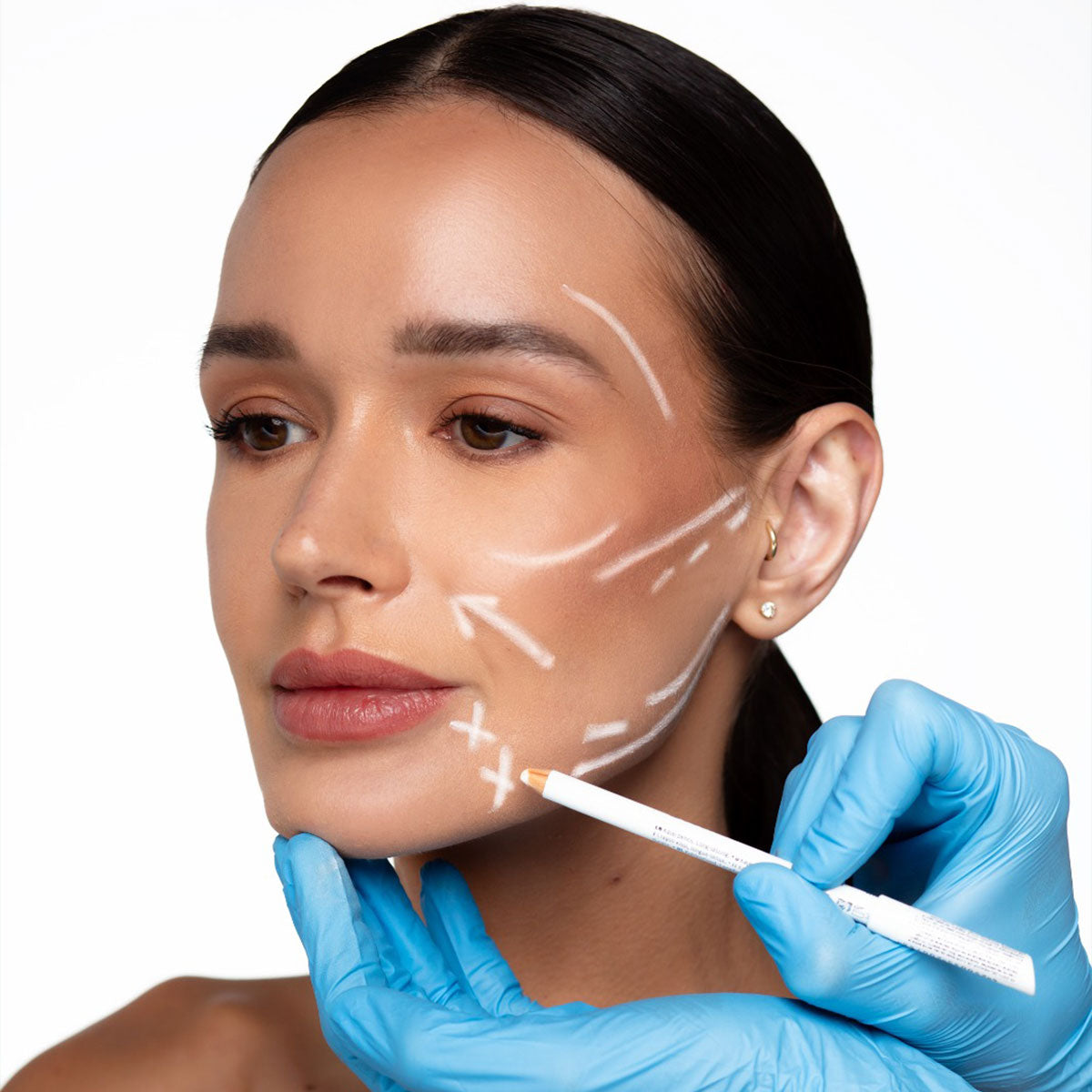 HIFU 12D Facial + Vitaminas Pink Glow